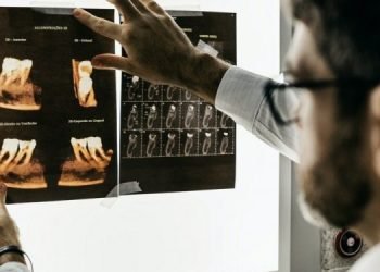 Sehabis Kurban Timbul Sakit Gigi, Berikut Pilihan Alternatif Obatnya